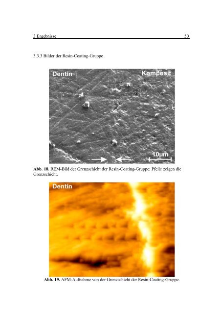 Dentin Komposit - OPUS - Universität Würzburg