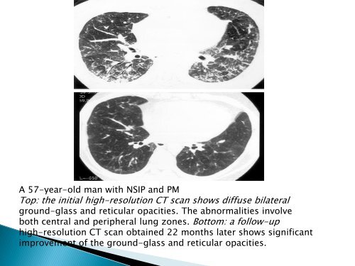 Dr Romi Singla - Department Of Pulmonary Medicine GMC, Patiala