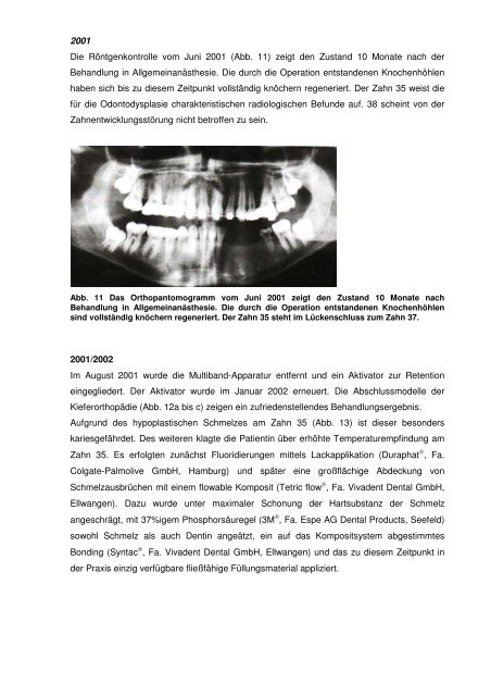 Odontodysplasie - zahn-hilfe.de