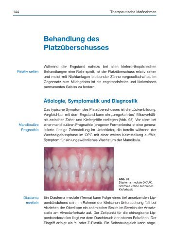 Behandlung des Platzüberschusses