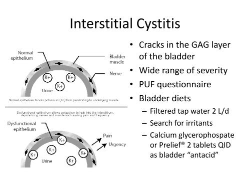 Dysuria with a Negative Urine Culture or When is a UTI not a UTI?