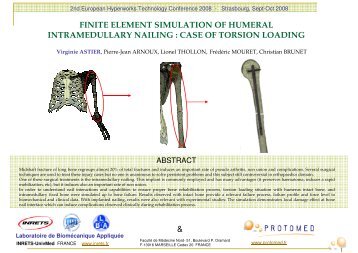 finite element simulation of humeral intramedullary nailing