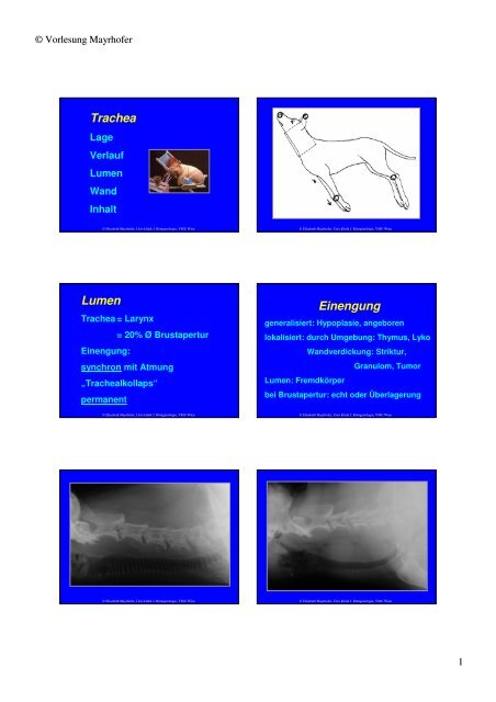 Trachea Lumen Einengung