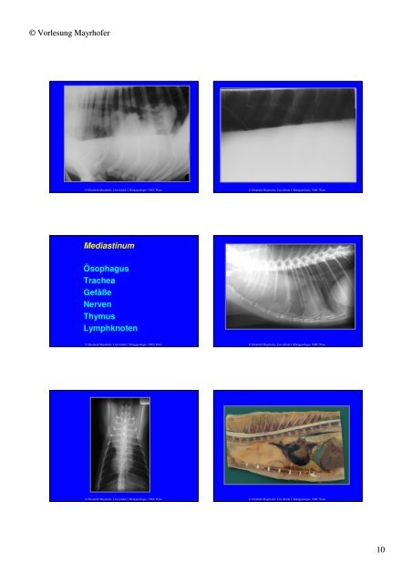 Trachea Lumen Einengung