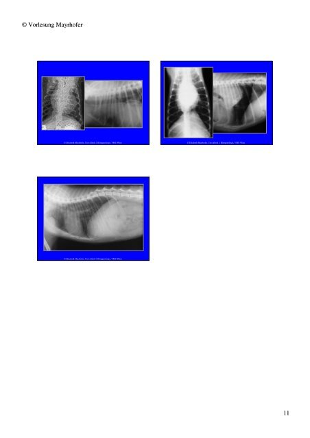 Trachea Lumen Einengung