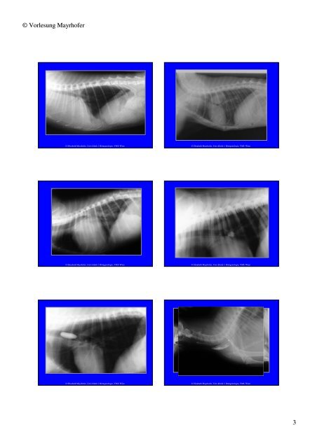 Trachea Lumen Einengung