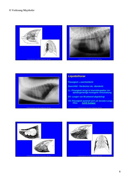 Trachea Lumen Einengung