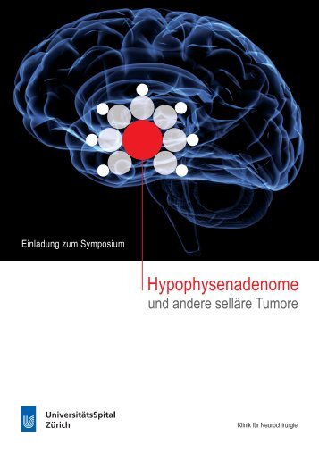 Hypophysenadenome - Fortbildung - UniversitätsSpital Zürich