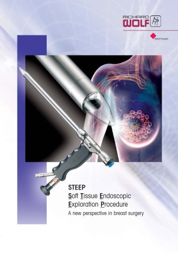 STEEP Soft Tissue Endoscopic Exploration Procedure - Richard Wolf