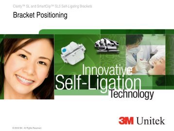 Clarity™ SL and SmartClip™ SL3 Self-Ligating Brackets - 3M Unitek ...