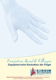 Dupuytren'sche Kontraktur der Finger - Klinikum Wels-Grieskirchen