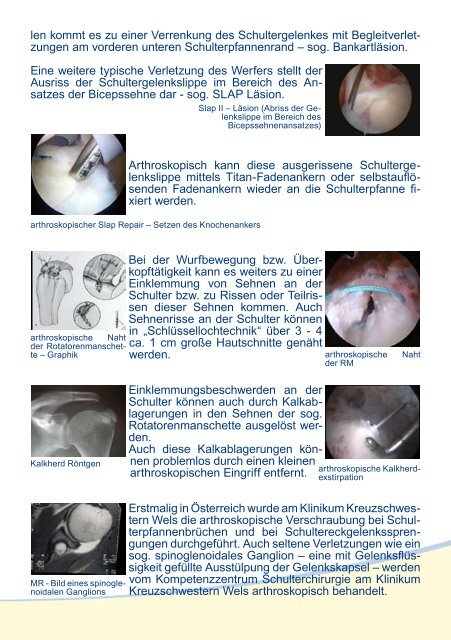 Arthroskopische Schulterchirurgie - Klinikum Wels-Grieskirchen