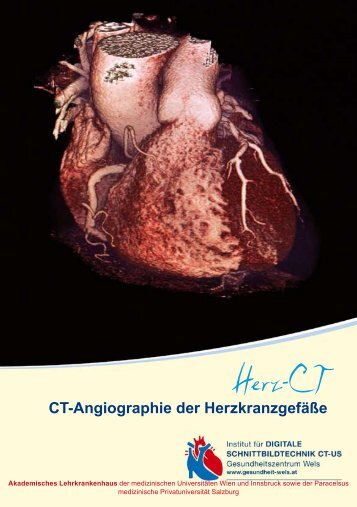 CT-Angiographie der Herzkranzgefäße - Klinikum Wels-Grieskirchen