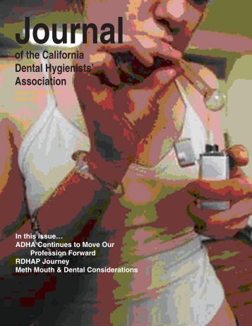 Journal Of The California Dental Hygienists' Association - Noel Kelsch