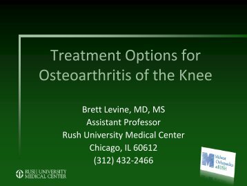 Treatment Options for Osteoarthritis of the Hip and Knee