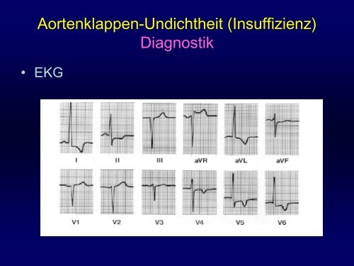 Mittlerer Gradient (mmHg) - Praxis für Kardiologie Innere Medizin Dr ...