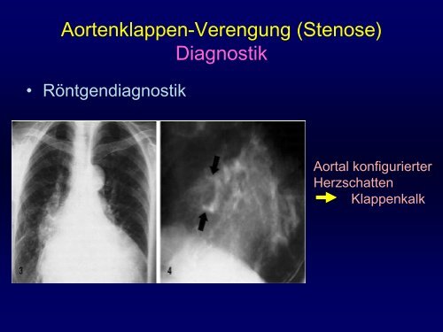 Mittlerer Gradient (mmHg) - Praxis für Kardiologie Innere Medizin Dr ...