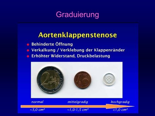 Mittlerer Gradient (mmHg) - Praxis für Kardiologie Innere Medizin Dr ...