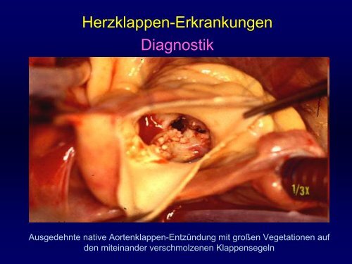 Mittlerer Gradient (mmHg) - Praxis für Kardiologie Innere Medizin Dr ...