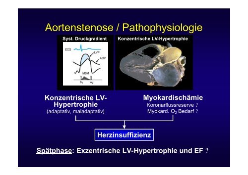 Aortenstenose bei älteren Patienten - Vereinigung Zuercher ...