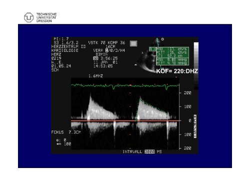 6. Klappenstenosen - Technische Universität Dresden