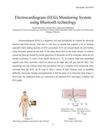 (ECG) Monitoring System using Bluetooth technology - Politeknik ...