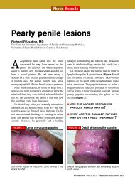 Photo Rounds Pearly penile lesions - The Journal of Family Practice
