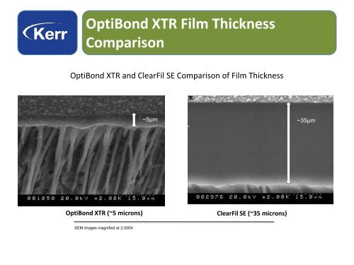 OptiBond™ XTR - kerr thailand