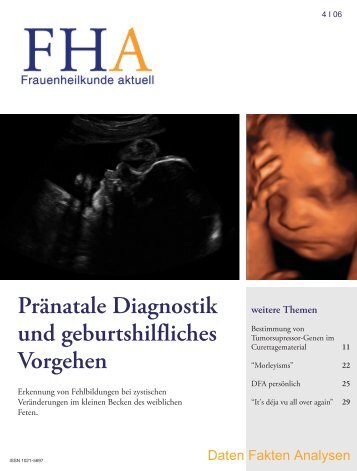 Pränatale Diagnostik und geburtshilfliches Vorgehen