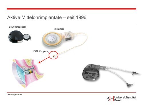 Vom Hörrohr zum CI - CI Interessengemeinschaft Schweiz