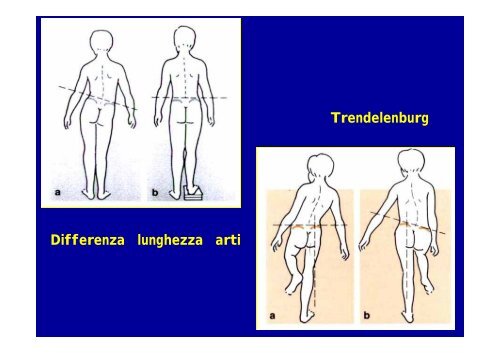 Le alterazioni del rachide e del bacino - Fimp