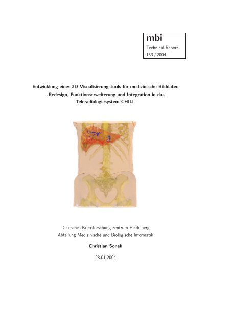 Technical Report 153 / 2004 Entwicklung eines 3D ... - Dkfz