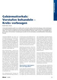 Gebärmutterhals: Vorstufen behandeln – Krebs ... - Heide Fischer
