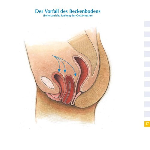 Das Hängemattenprinzip - Dr. med. Ilie Bumbu