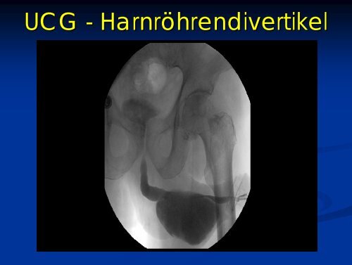 Rekonstruktive Urologie und Kinderurologie