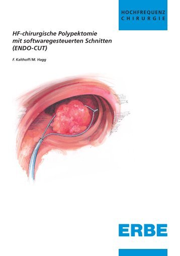 ENDO-CUT - Wieser Medizintechnik