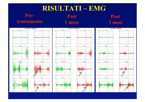 toe-walking idiopatico - CSR Congressi srl