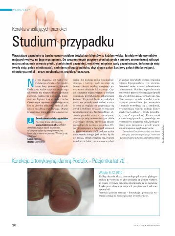 Studium przypadku - Beauty Forum