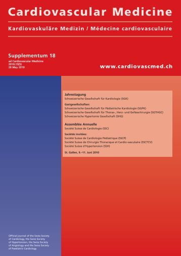 La vena su una gamba è visibile, ma non sporge