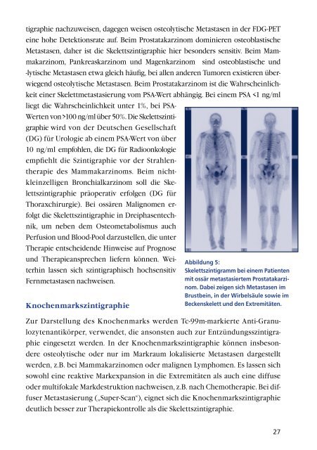 Prostatakarzinom - Dr. med. Wasylewski