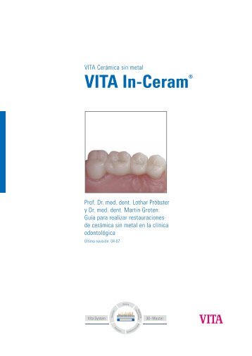 VITA In-Ceram® Professionals