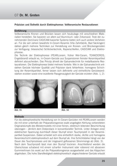 Kurzreferate 2006 - Arbeitsgemeinschaft Dentale Technologie eV