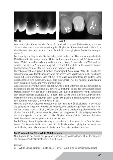 Kurzreferate 2006 - Arbeitsgemeinschaft Dentale Technologie eV