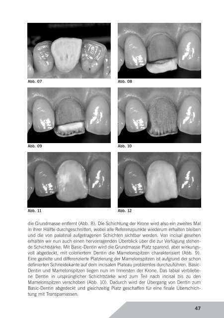 Kurzreferate 2006 - Arbeitsgemeinschaft Dentale Technologie eV