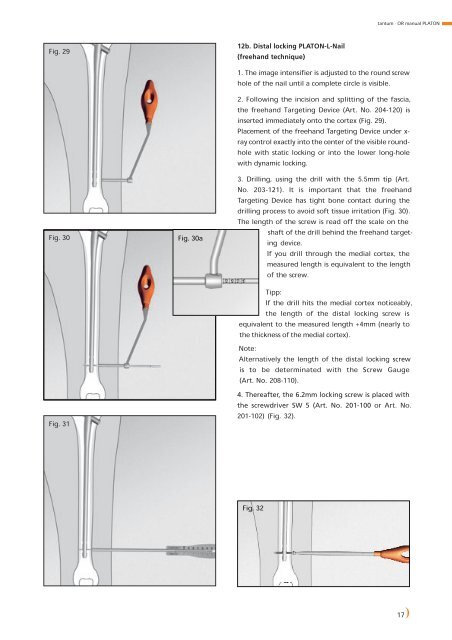 PLATON-Locking-Nail-System - tantum AG