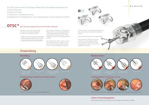 OTSC® Produkte OTSC® System - Ovesco Endoscopy AG