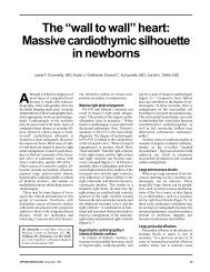The “wall to wall” heart: Massive cardiothymic silhouette in newborns