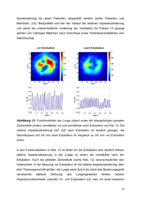 Postoperatives Monitoring der regionalen Lungenventilation durch ...