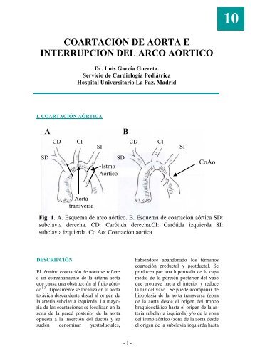 10 coartacion de aorta e interrupcion del arco aortico - Asociación ...