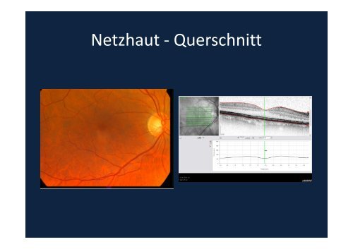 Verblitzt, verstrahlt – licht- und strahleninduzierte ...